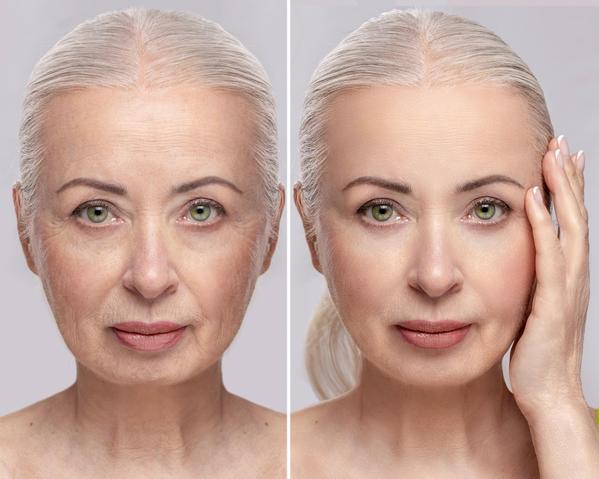 Anti-Ageing Treatment is not a