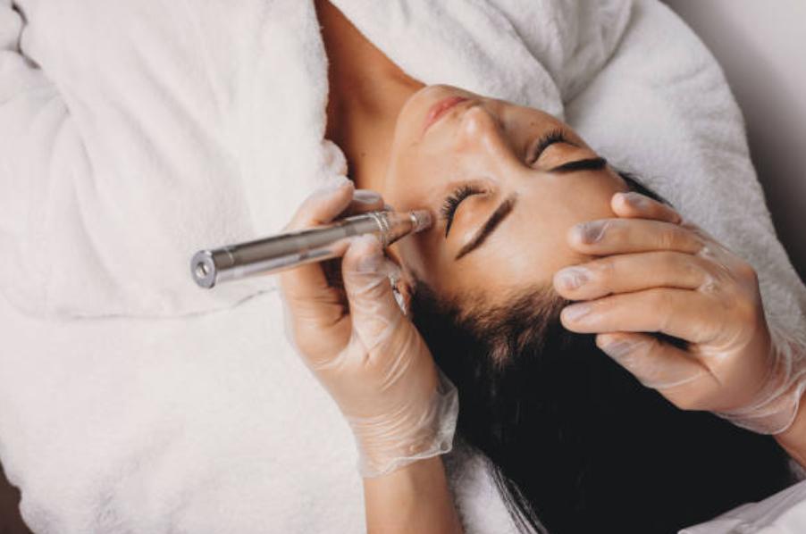 Microdermabrasion appeals to t