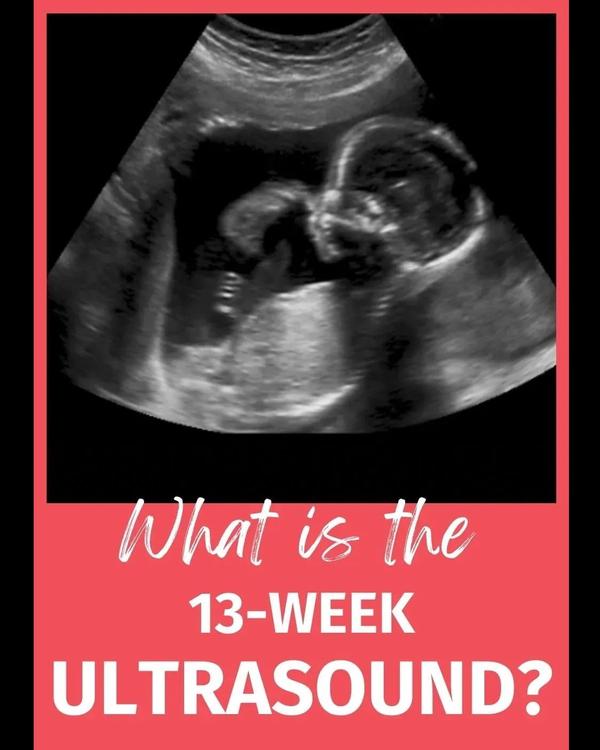 
NTNB ulrasound in rohini delh