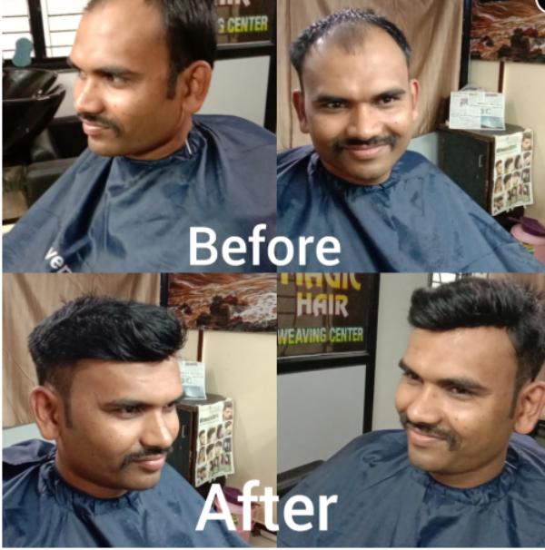 A well designed hair wig can instantly t