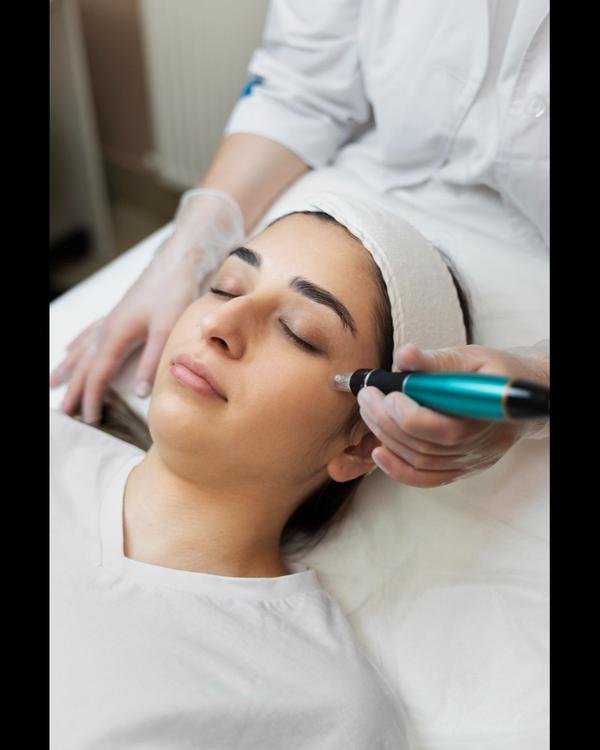 Microneedling Treatment is oft