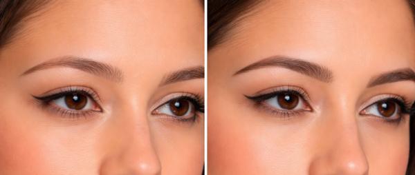 Eyebrow microblading treatment