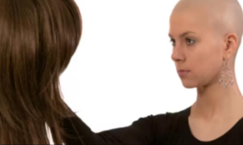 Hair loss during chemotherapy can be emo