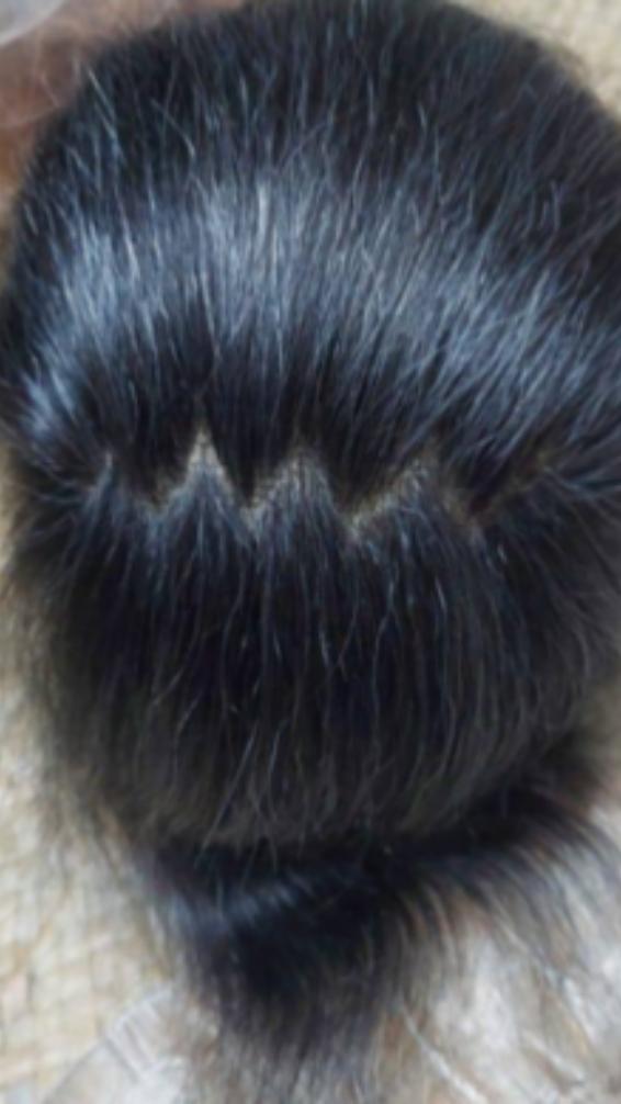 Hair plays an important role in a woman’