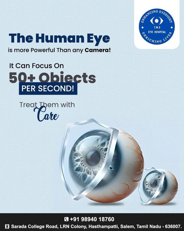affordable cataract surgery sa