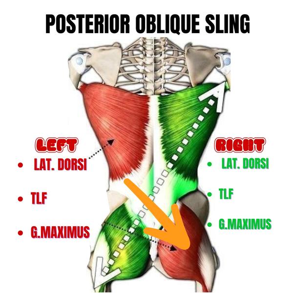 The Posterior Oblique Sling (P