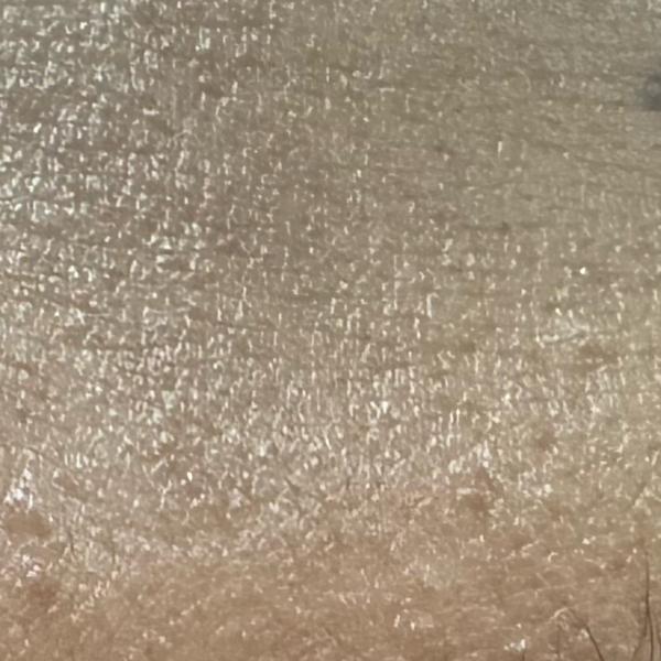 Vibha skin, hair and laser cli