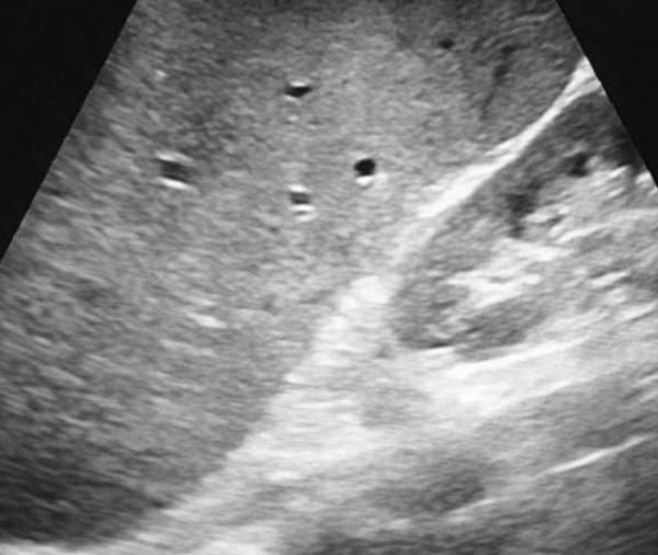 

Whole Abdomen USG at Dr Mitt