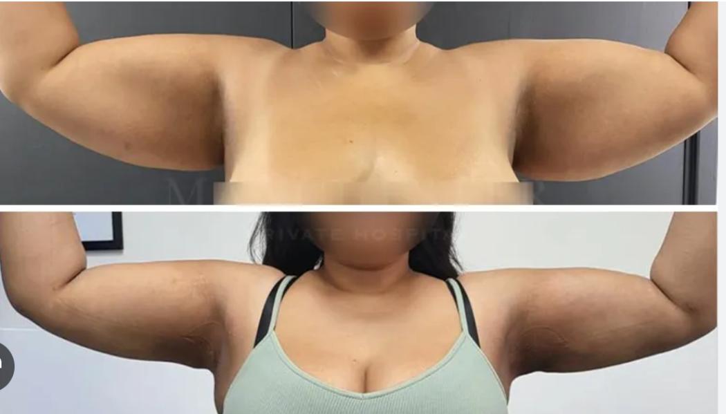 update image