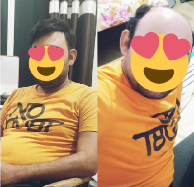 Hair loss solutions have evolved signifi