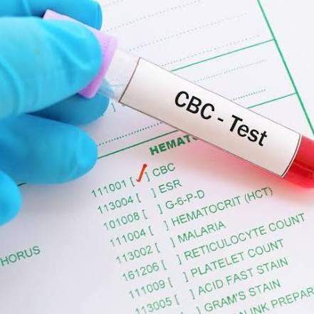 CBC Test in Rohini – Dr Mittal
