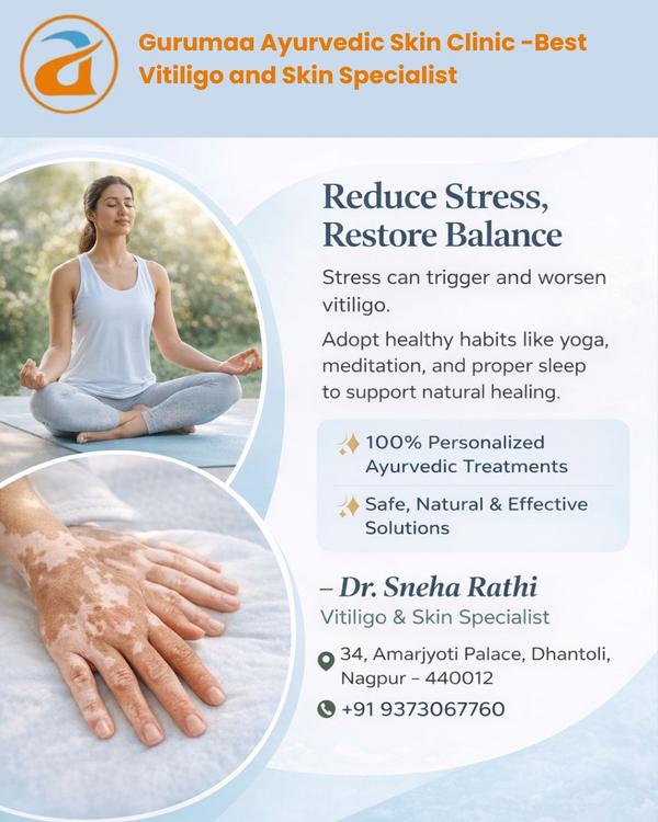 Vitiligo is not just a skin condition—it affects s