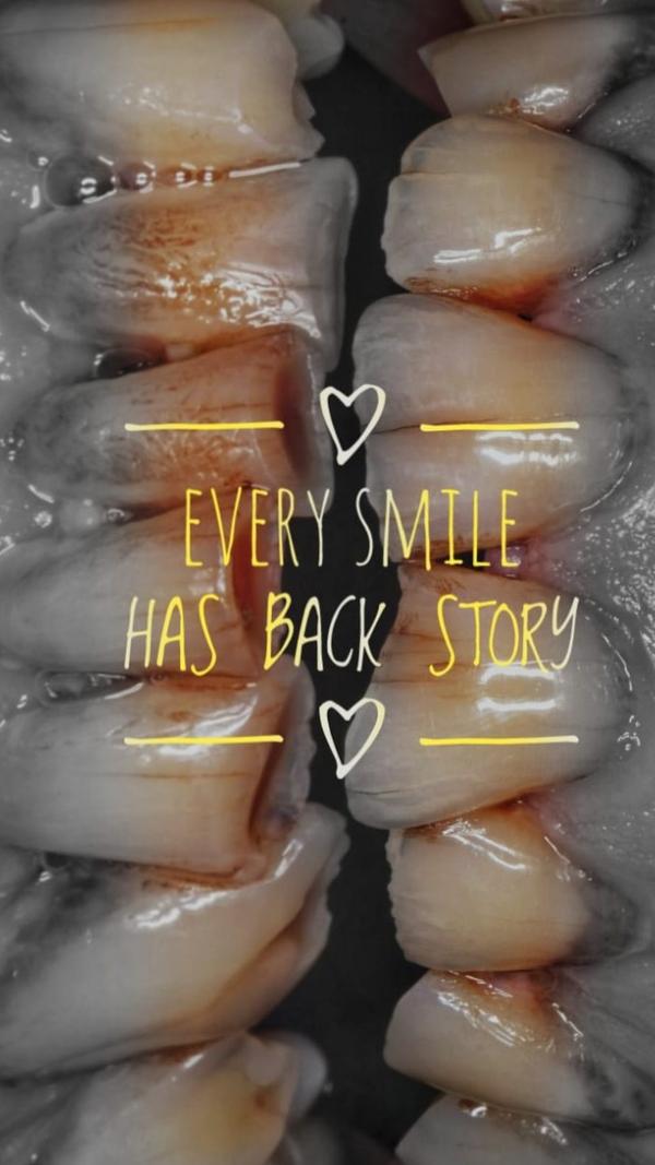 Digital smile designing E