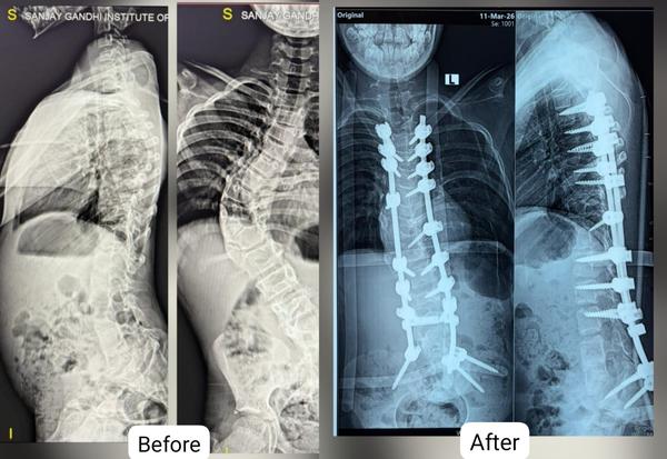 update image