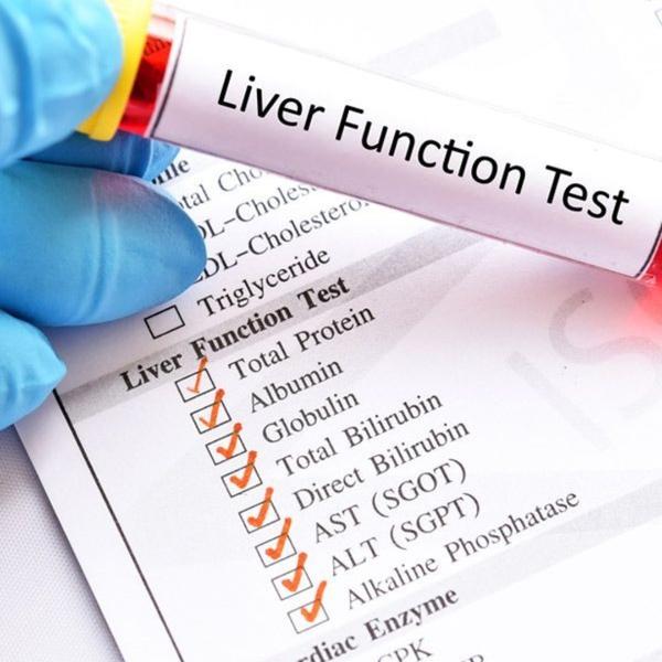 Liver Function Test (LFT) in R