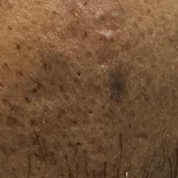 Vibha skin, hair and laser cli