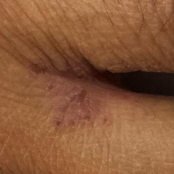 Dr.s.Valarmathi, a skin doctor