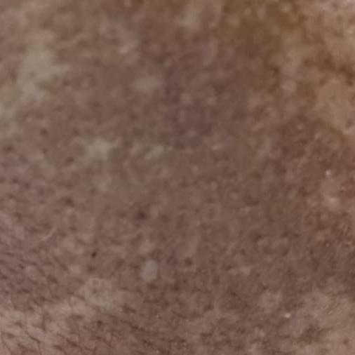 Vibha skin, hair and laser cli