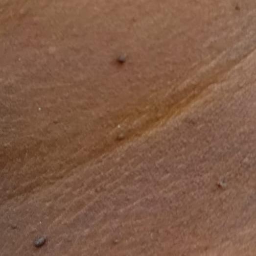 Vibha skin, hair and laser cli