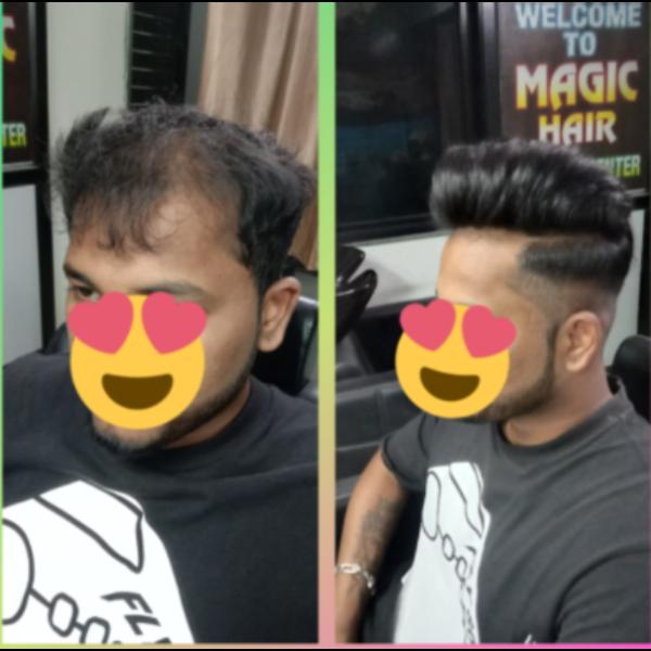 Hair Bonding Center in Nagpur is seeing 