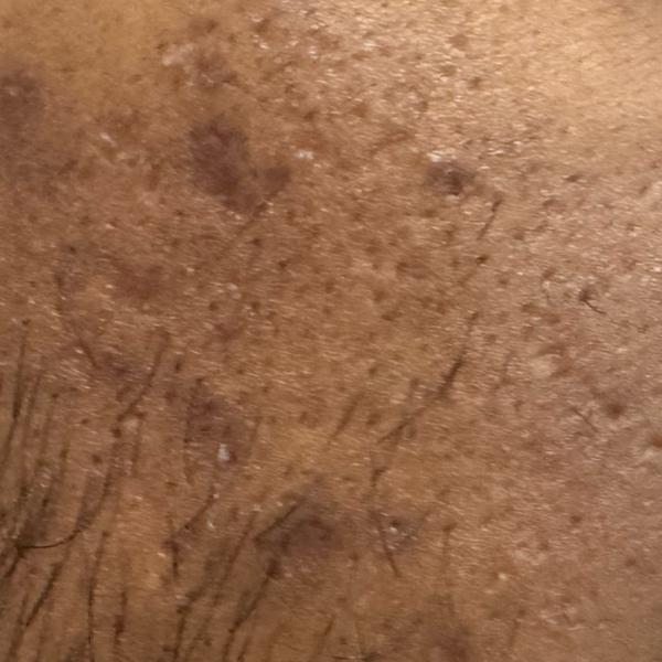 Vibha skin, hair and laser cli