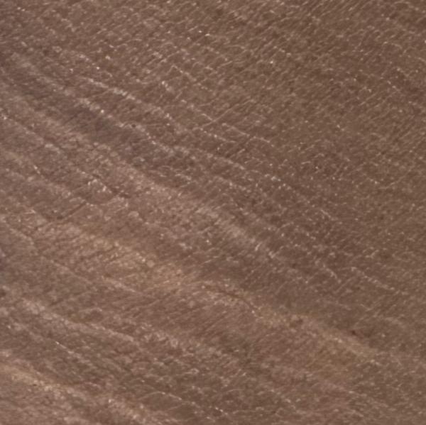 Vibha skin, hair and laser cli