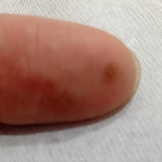 Vibha skin, hair and laser cli