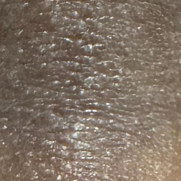 Dr.s.Valarmathi, a skin doctor