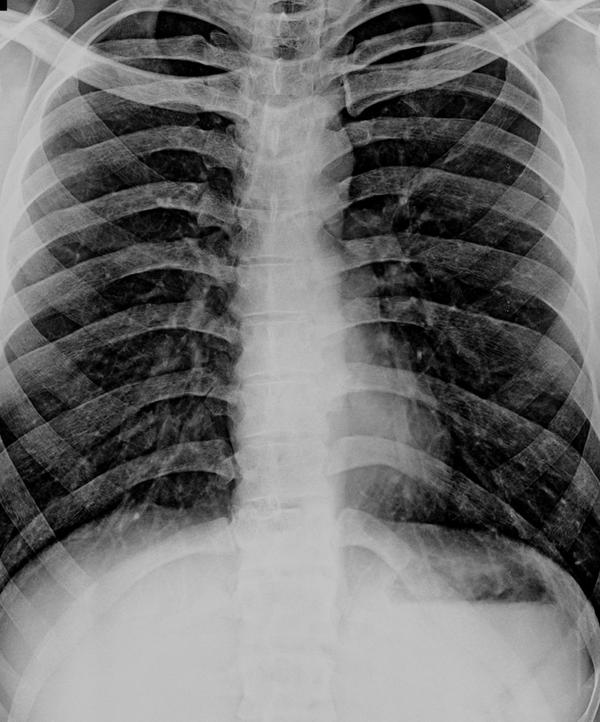 


Advanced Digital X-Ray Serv