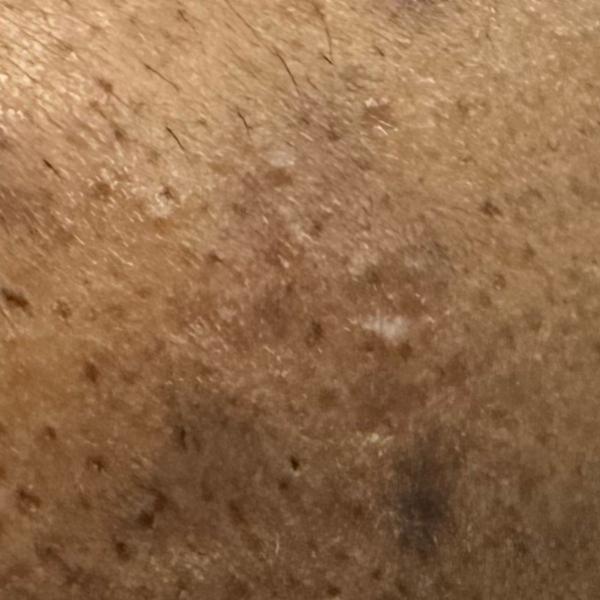 affordable dermatology service
