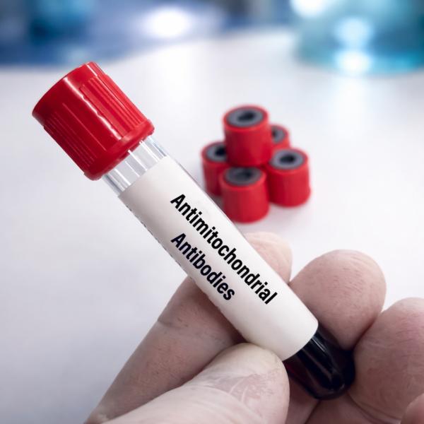 Anti Mitochondrial Antibody Te