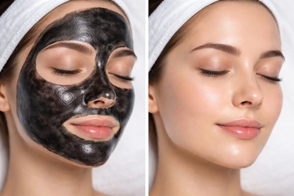 Black peel treatment is often 