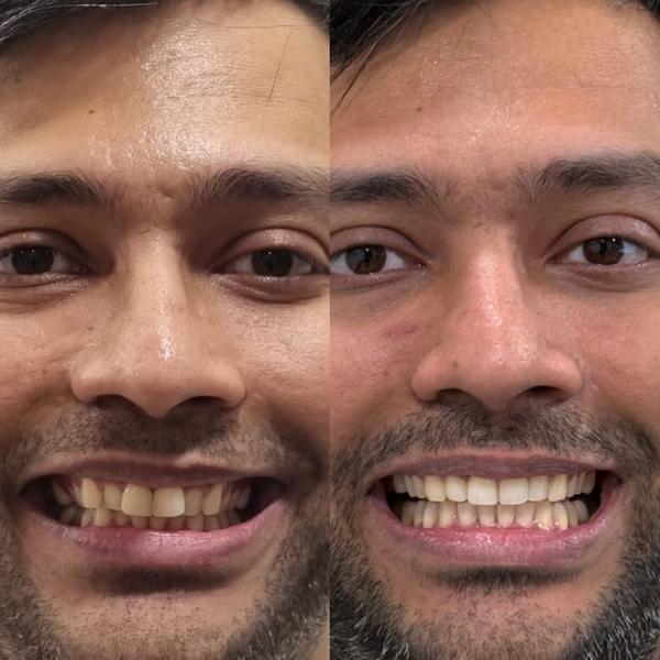update image