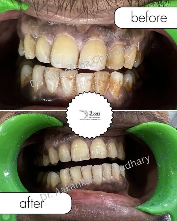 update image