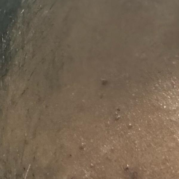 Vibha skin, hair and laser cli