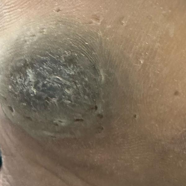 Vibha skin, hair and laser cli