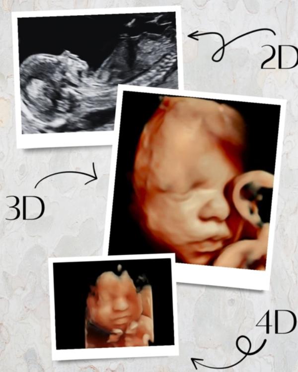 


3D & 4D Ultrasound in Rohin