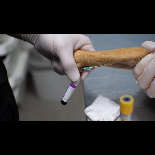 CBC, LFT, and KFT tests help e