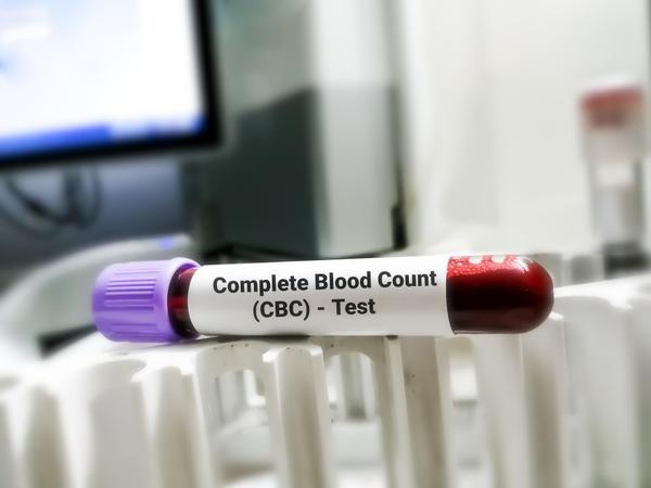 Complete Blood Count Test with