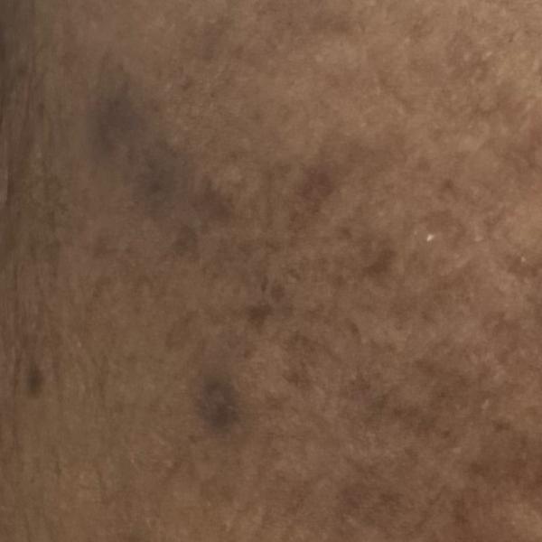 Vibha skin, hair and laser cli