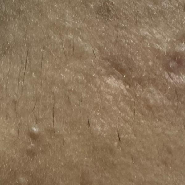 Vibha skin, hair and laser cli