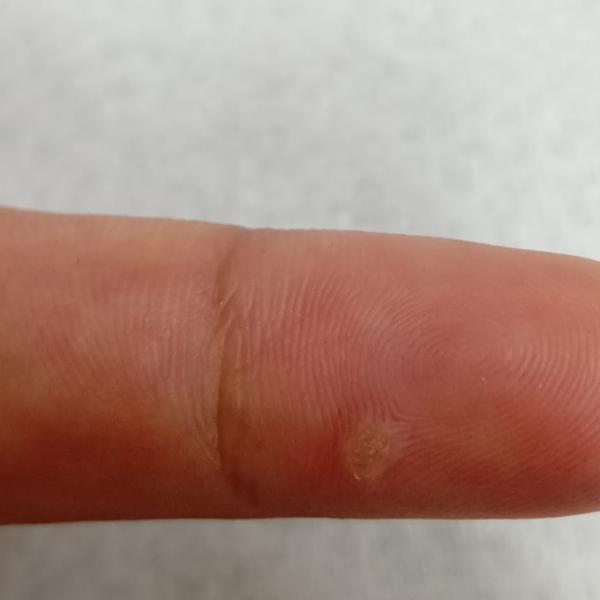 Vibha skin, hair and laser cli