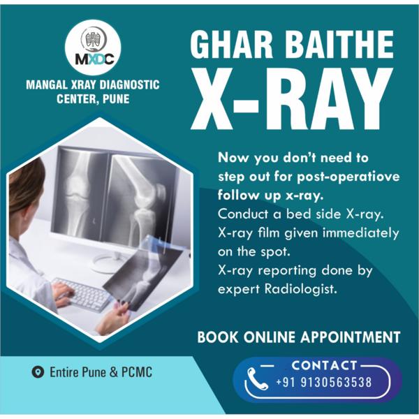 X-Ray at Home for Bedridden Pa