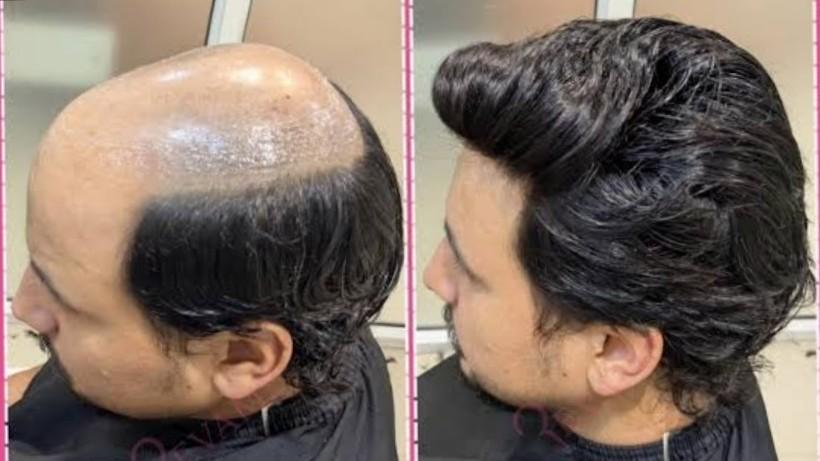 best human hair in Rohini best