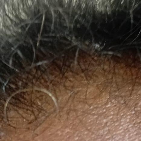 Dr.s.Valarmathi, the best skin