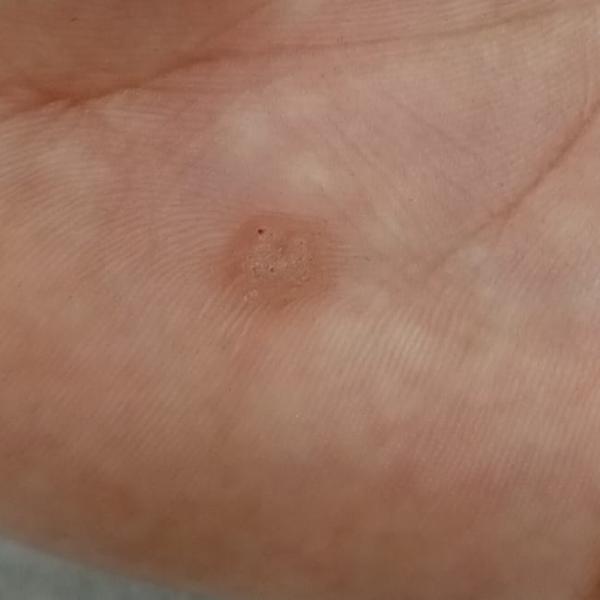 Vibha skin, hair and laser cli