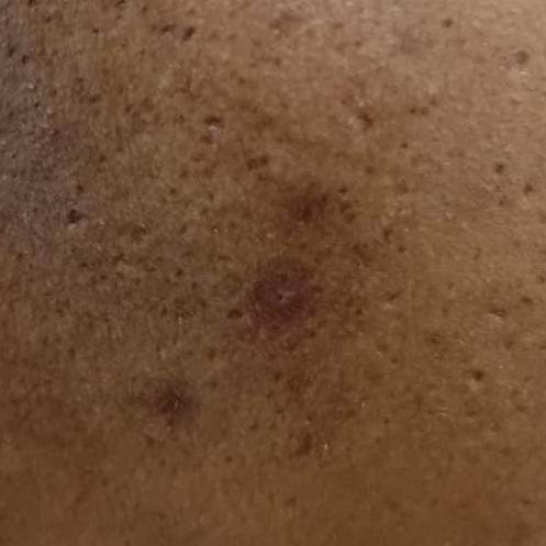 Vibha skin, hair and laser cli