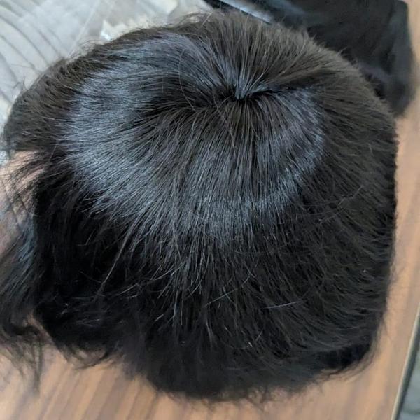 Hair loss is a common concern among men 