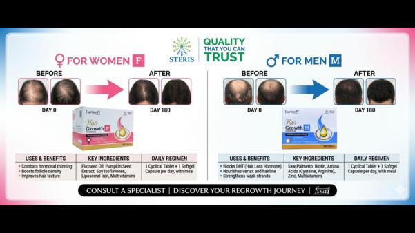 Hair fall is one of the most common concerns faced