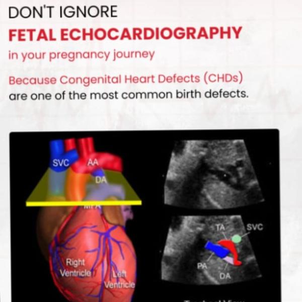 Advanced Fetal Echocardiograph